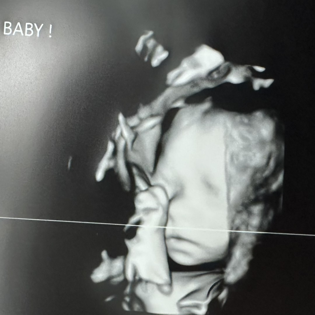 Photo shared by Kelsie for their Babylist baby registry.