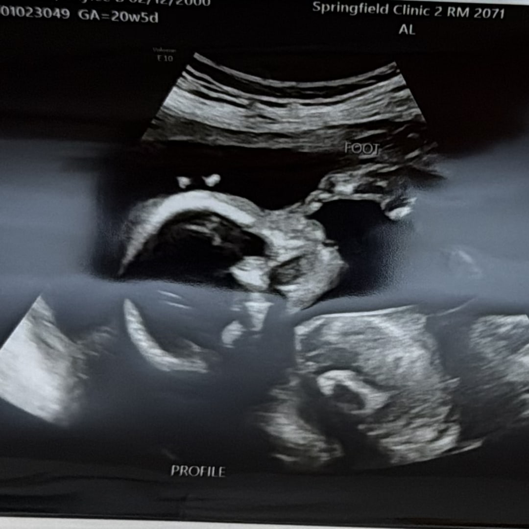 Photo shared by Baylee for their Babylist baby registry.
