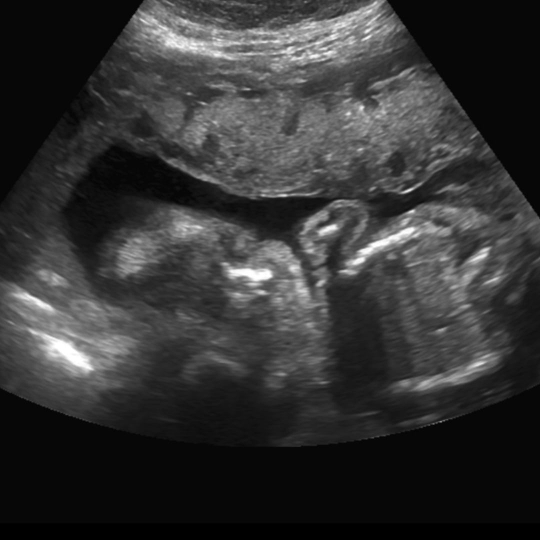 Photo shared by Franciris for their Babylist baby registry.