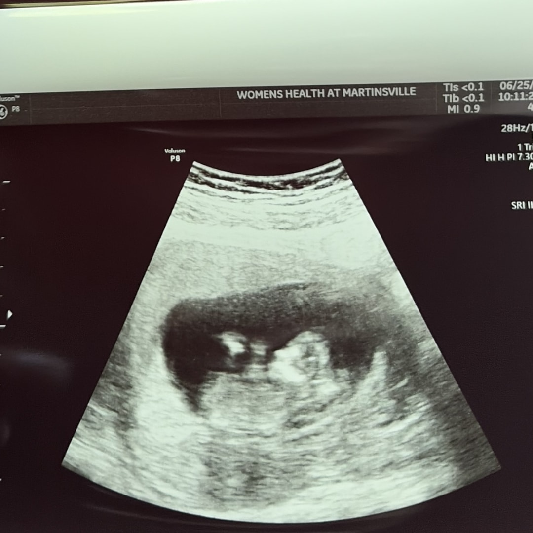 Photo shared by Amanda for their Babylist baby registry.