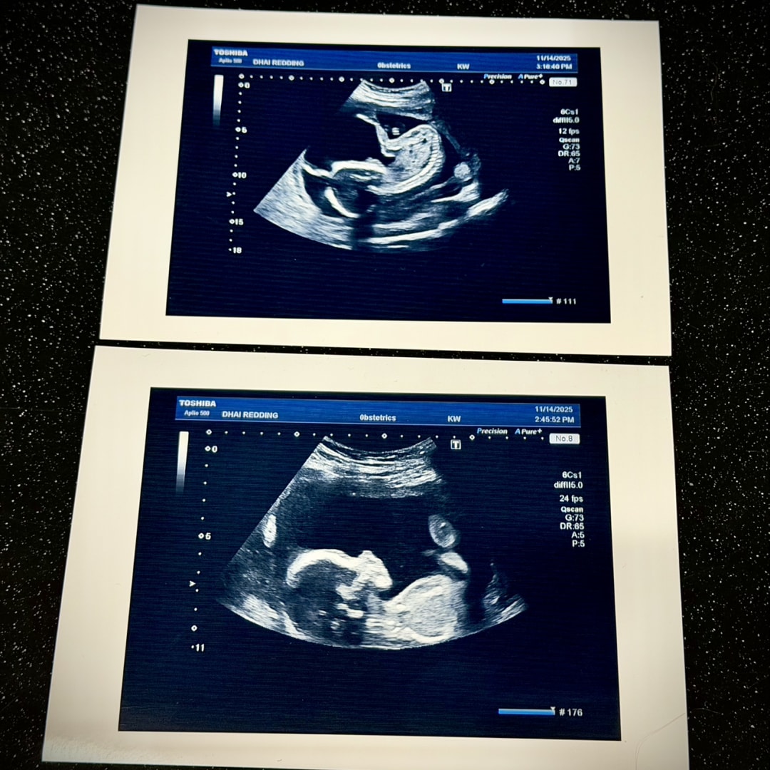 Photo shared by Amanda for their Babylist baby registry.