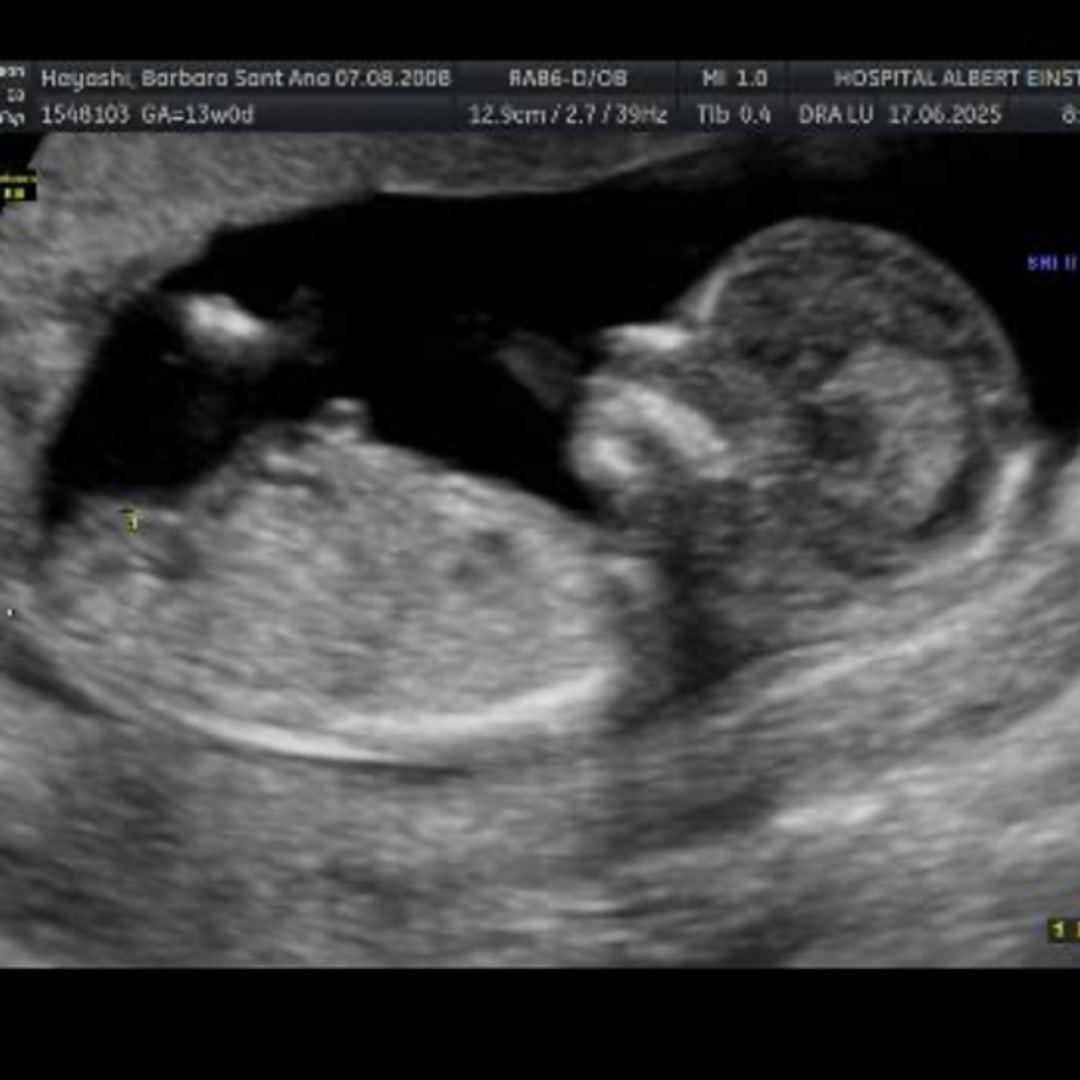 Photo shared by Barbara for their Babylist baby registry.