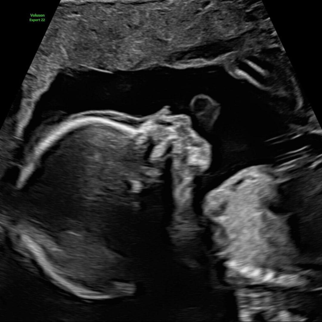 Photo shared by Cristal for their Babylist baby registry.