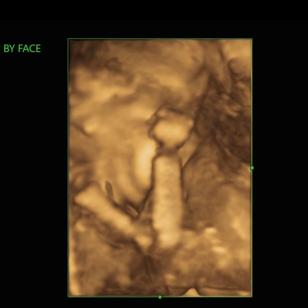 Photo shared by Katie for their Babylist baby registry.