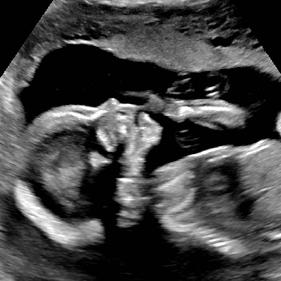 Photo shared by JoAna for their Babylist baby registry.