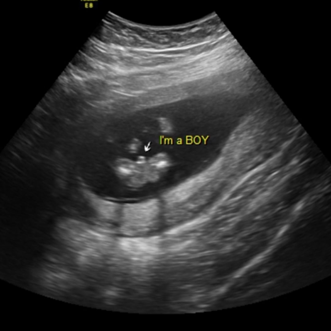 Photo shared by Kirsten for their Babylist baby registry.