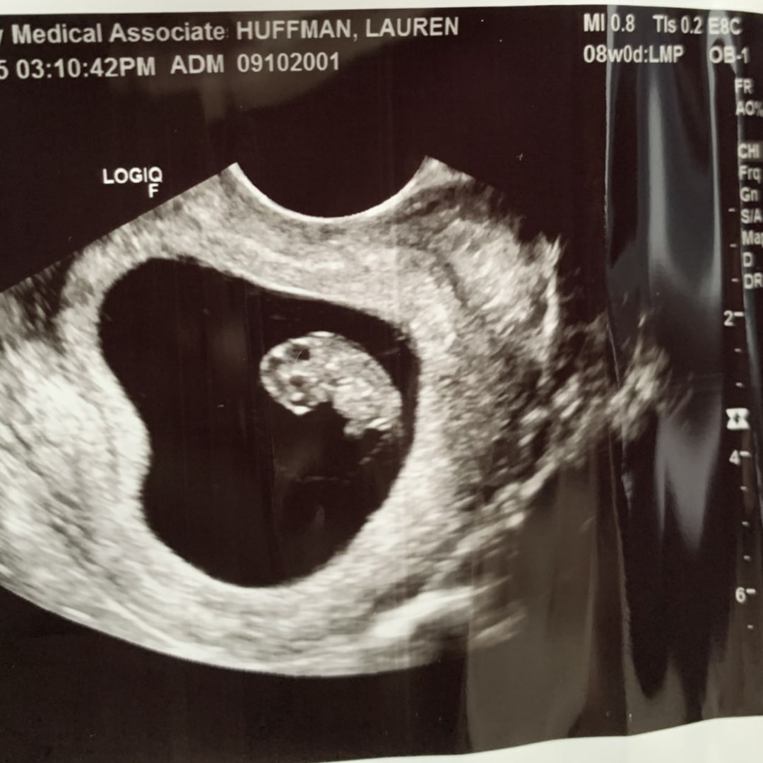 Photo shared by Lauren for their Babylist baby registry.