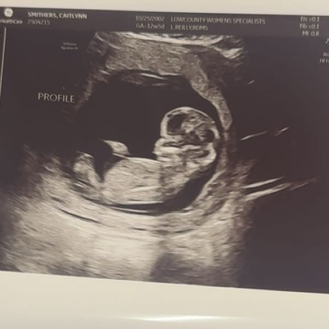 Photo shared by Caitlynn for their Babylist baby registry.