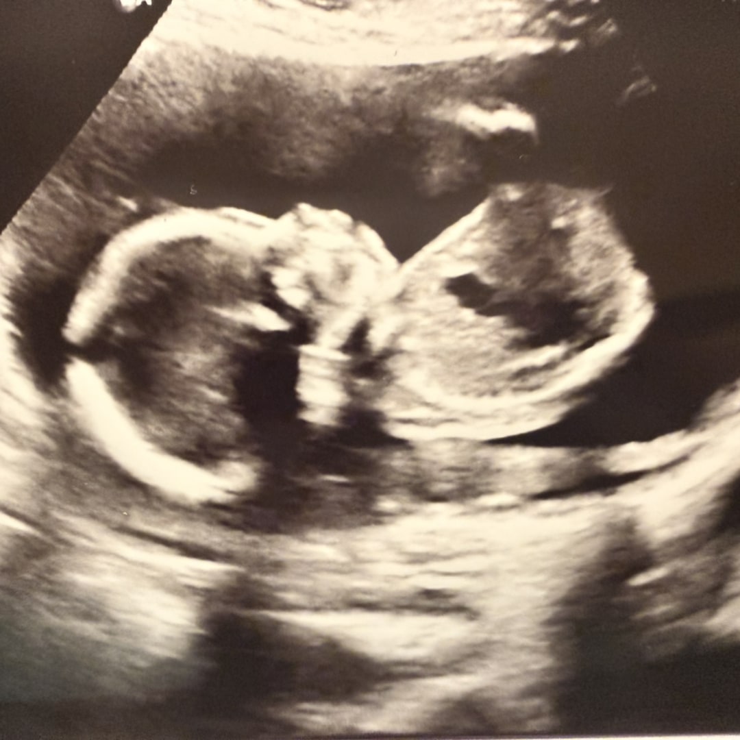 Photo shared by Amber for their Babylist baby registry.