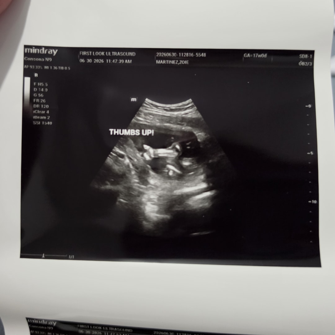 Photo shared by Zoie for their Babylist baby registry.