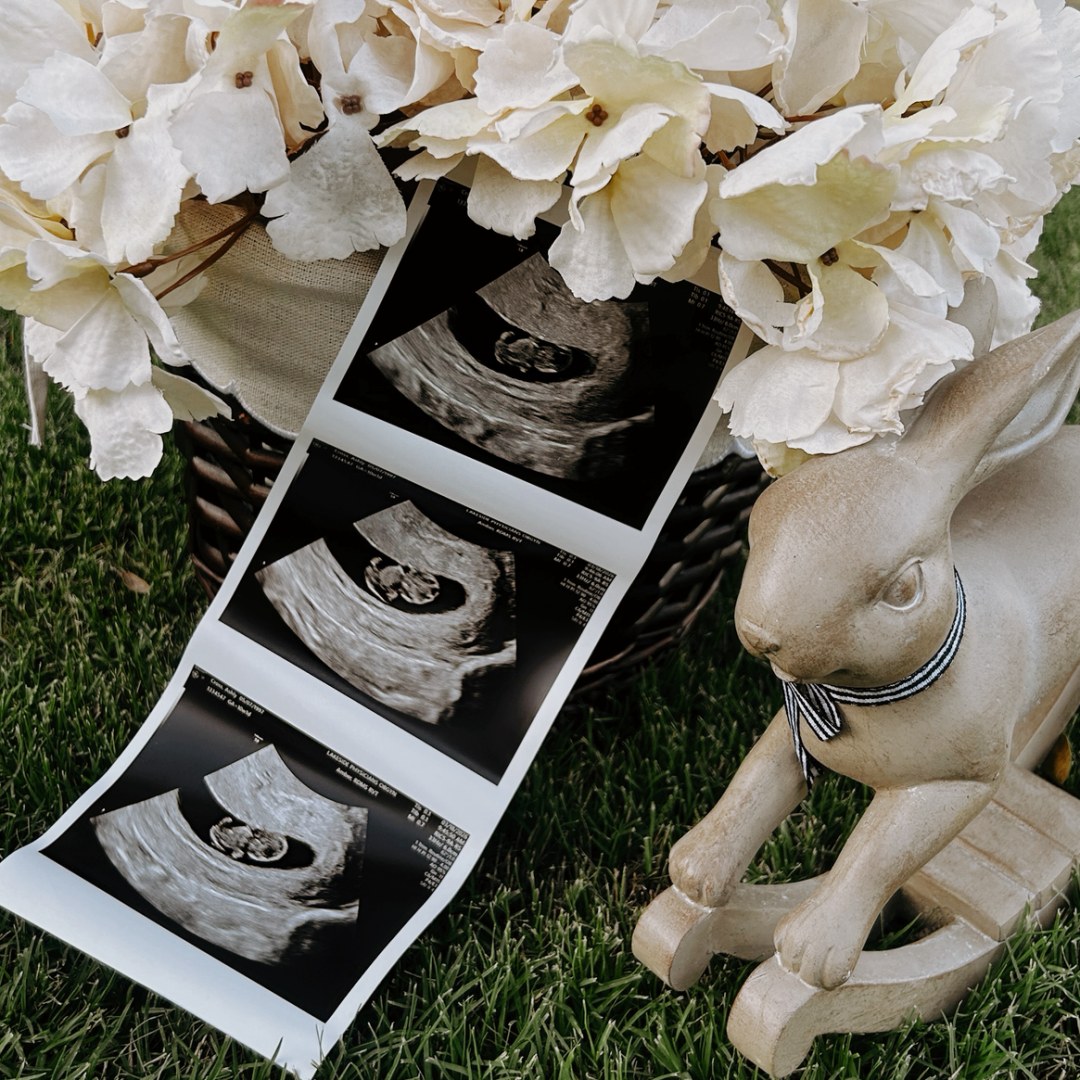 Photo shared by Ashly for their Babylist baby registry.