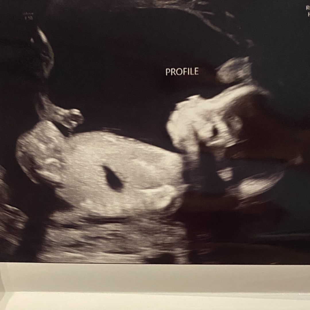 Photo shared by Bibiana for their Babylist baby registry.