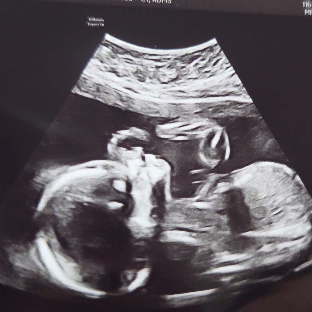 Photo shared by Sarah for their Babylist baby registry.