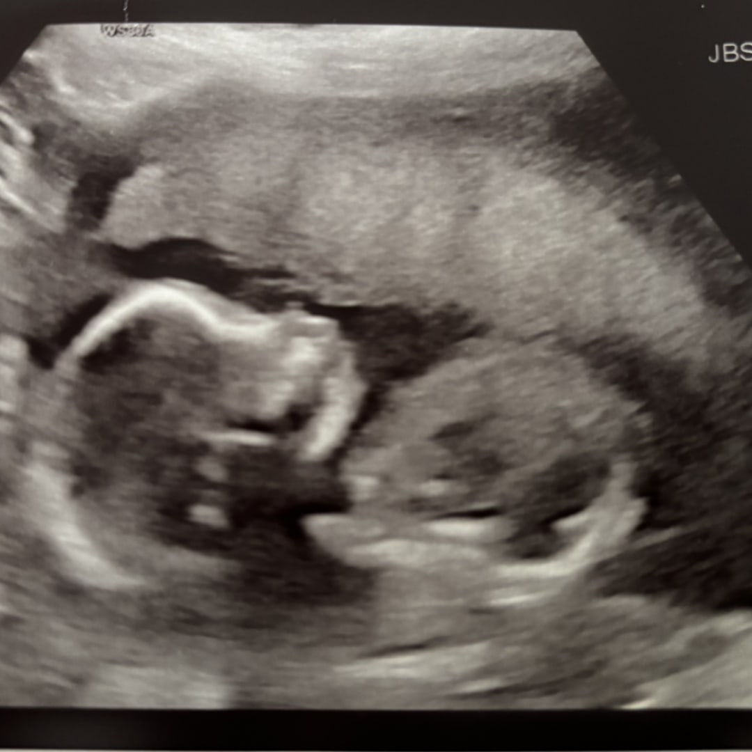 Photo shared by Hailey for their Babylist baby registry.