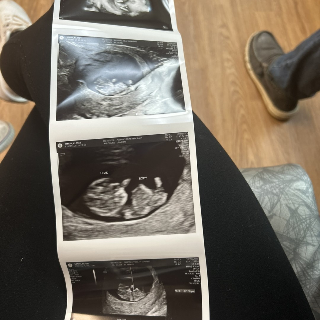 Photo shared by Klasey for their Babylist baby registry.