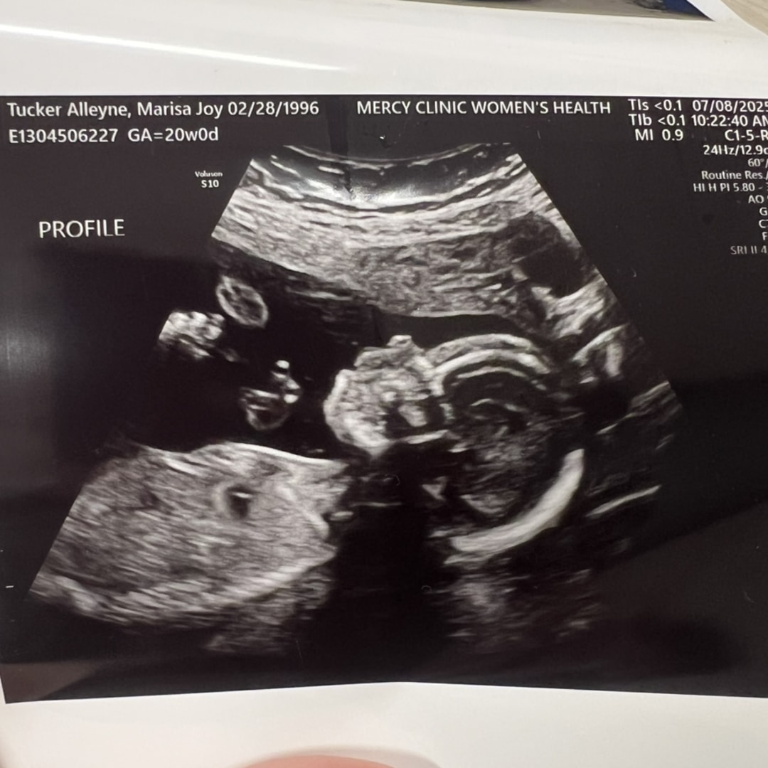 Photo shared by Marisa for their Babylist baby registry.