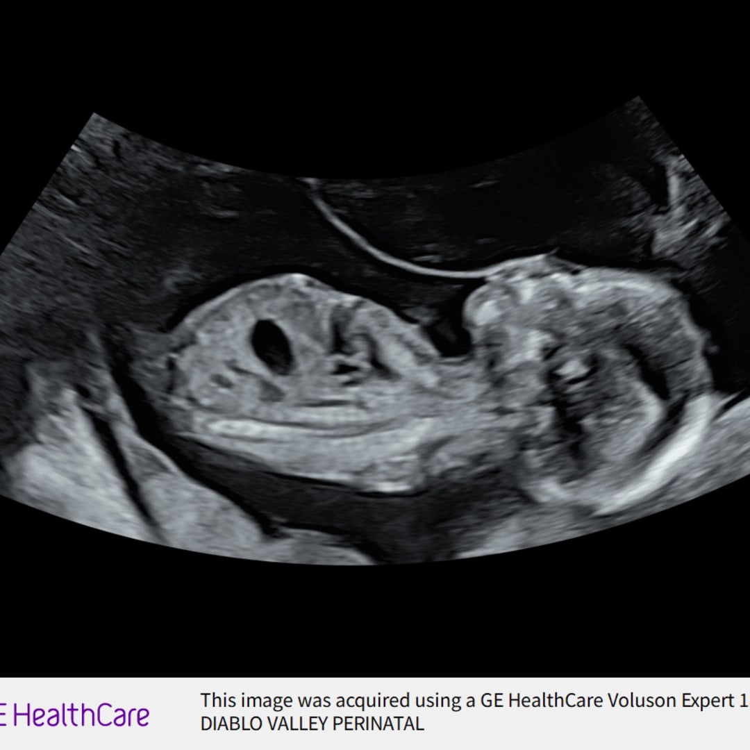 Photo shared by Brittany for their Babylist baby registry.