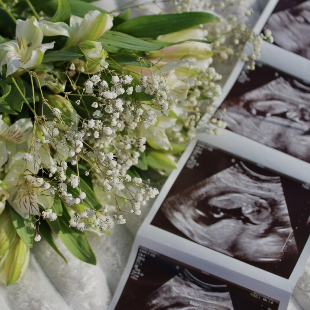 Photo shared by Brianna for their Babylist baby registry.