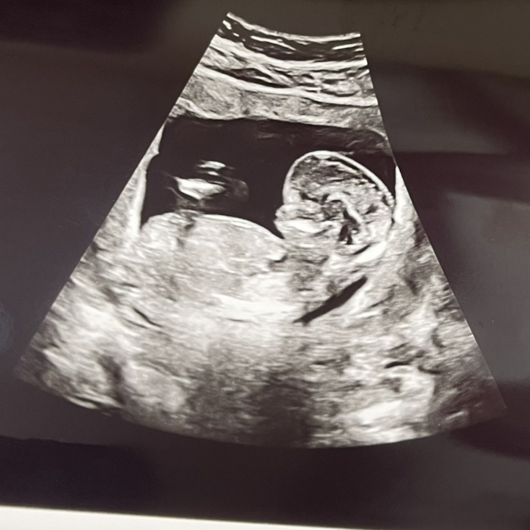 Photo shared by Clarice for their Babylist baby registry.