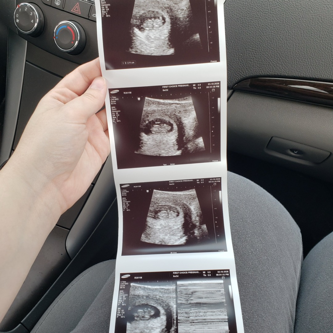 Photo shared by Allie for their Babylist baby registry.