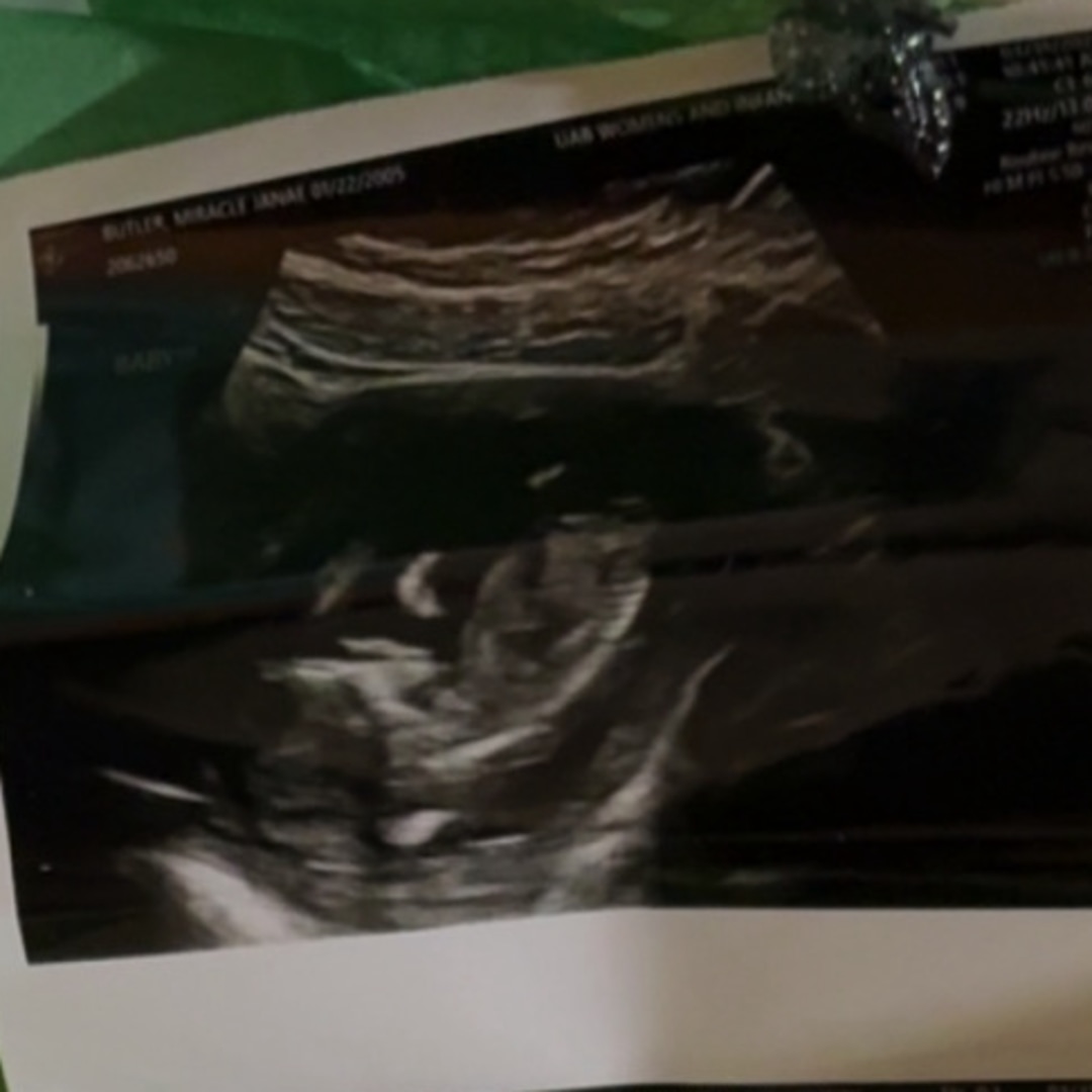 Photo shared by Miracle for their Babylist baby registry.