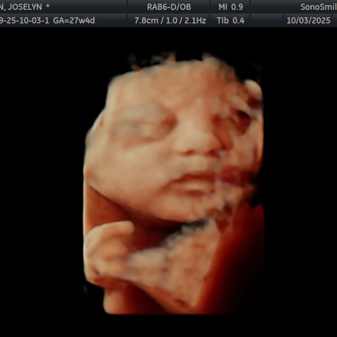 Photo shared by Joselyn for their Babylist baby registry.