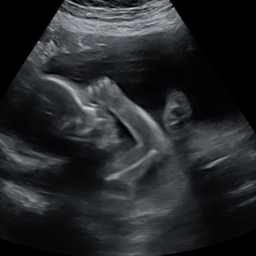 Photo shared by Elizabeth for their Babylist baby registry.