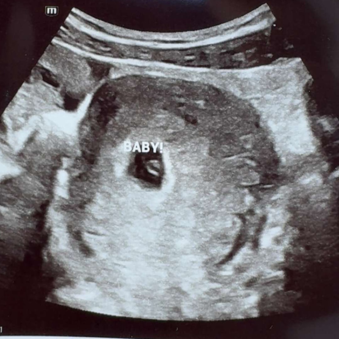 Photo shared by Icecess for their Babylist baby registry.