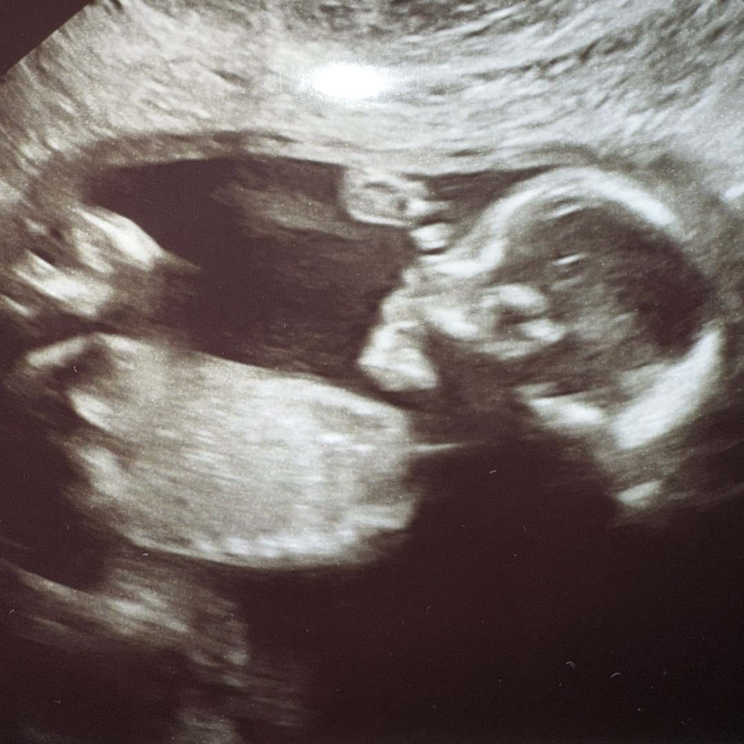 Photo shared by Eden for their Babylist baby registry.