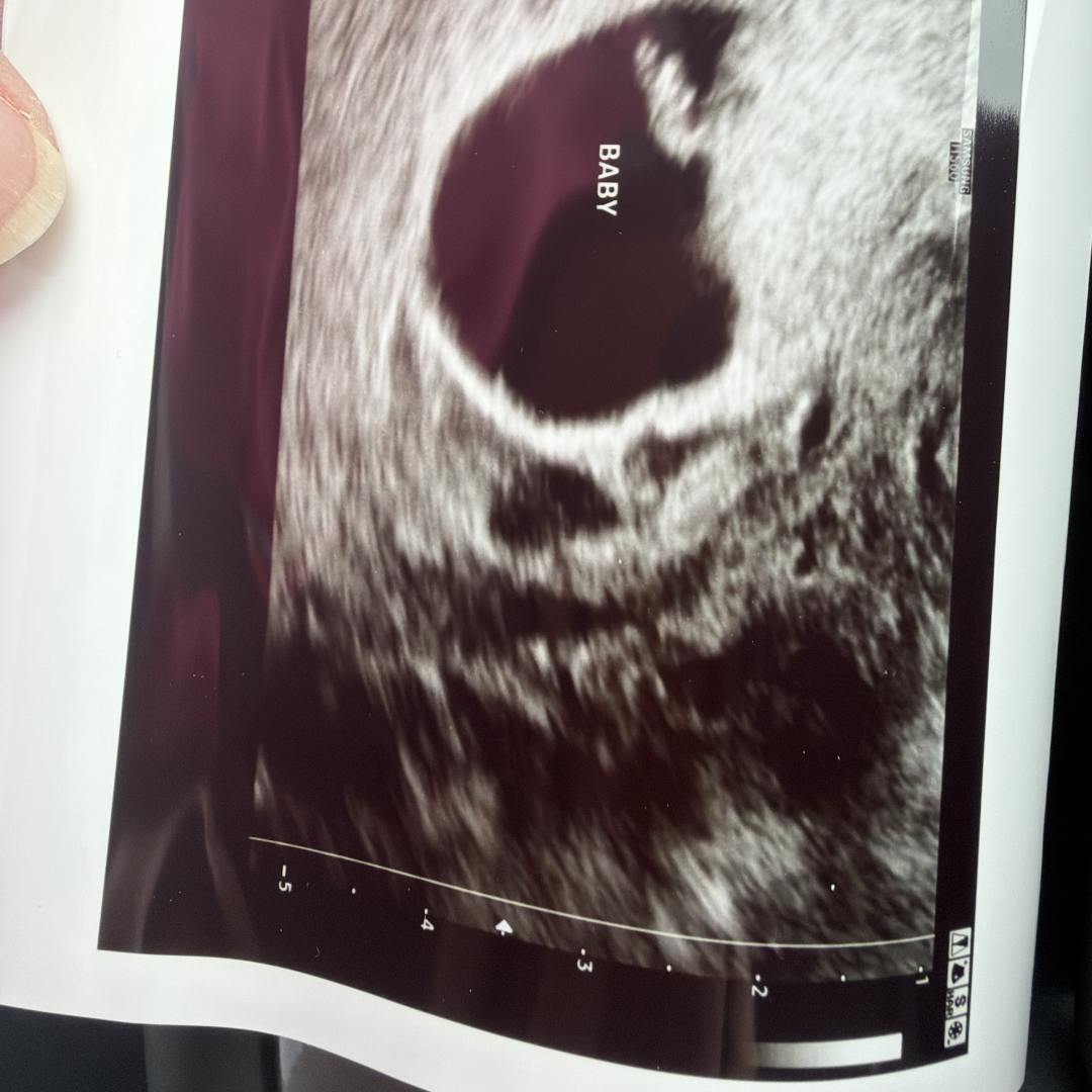 Photo shared by Jessica for their Babylist baby registry.