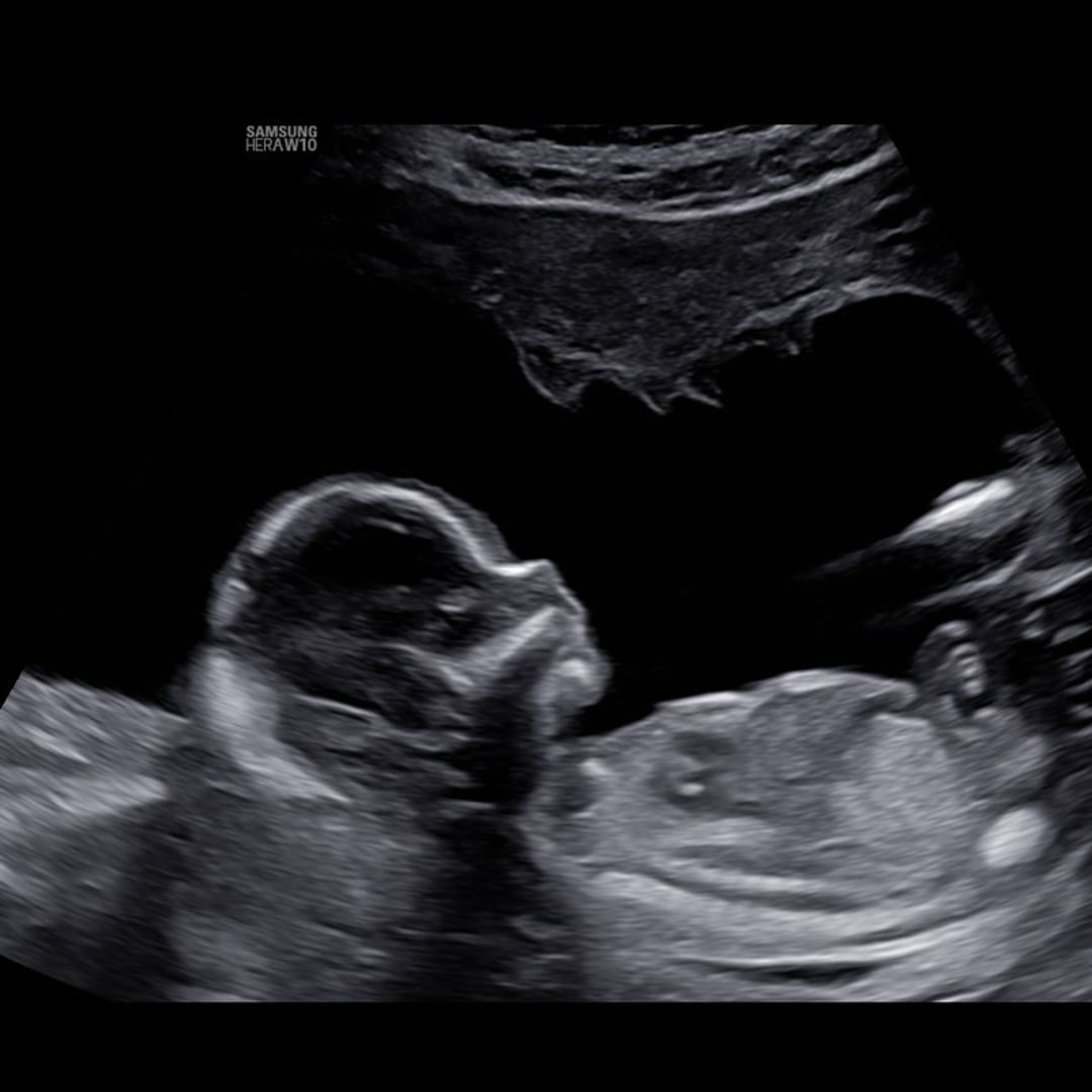 Photo shared by Christina for their Babylist baby registry.