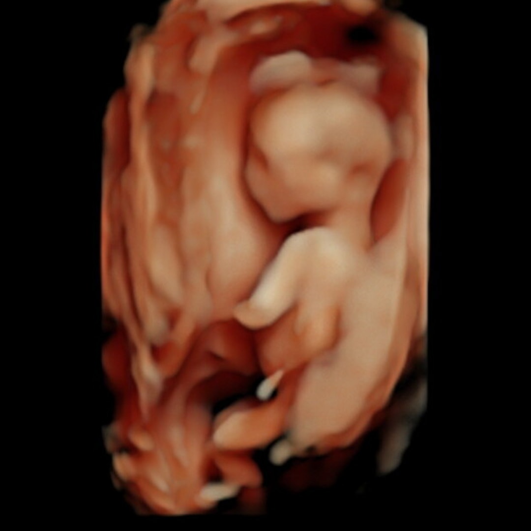 Photo shared by Jolie for their Babylist baby registry.