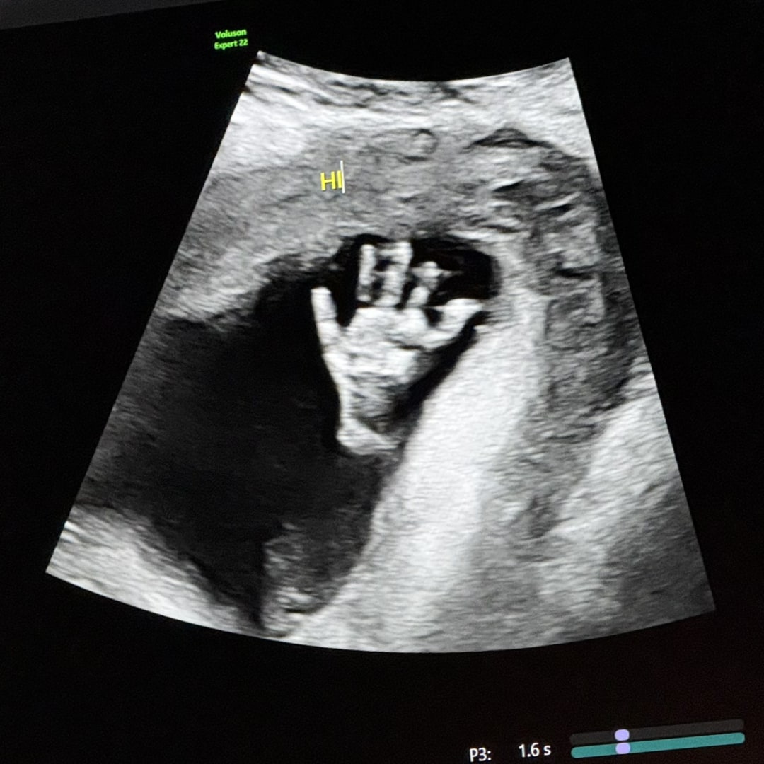 Photo shared by Amanda for their Babylist baby registry.