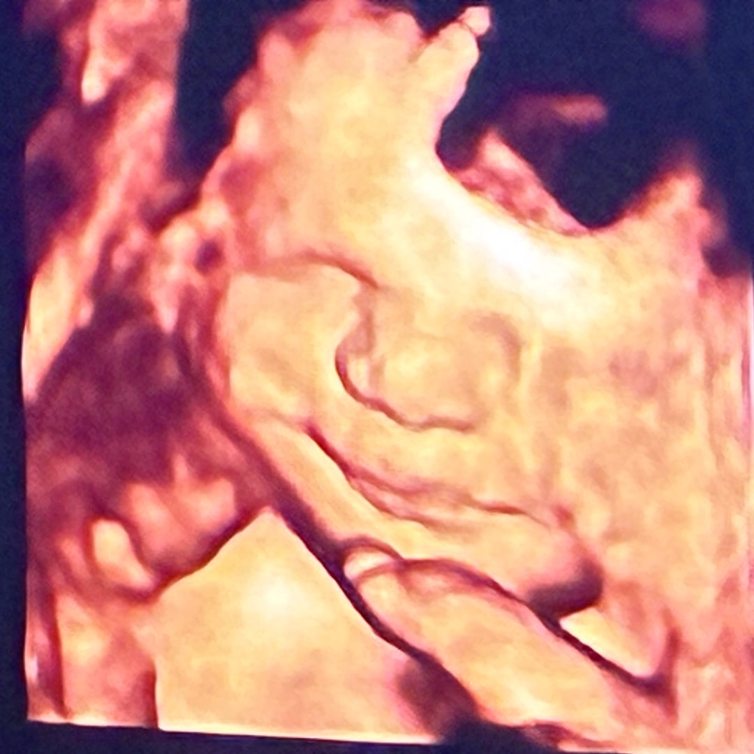 Photo shared by LaChelle for their Babylist baby registry.