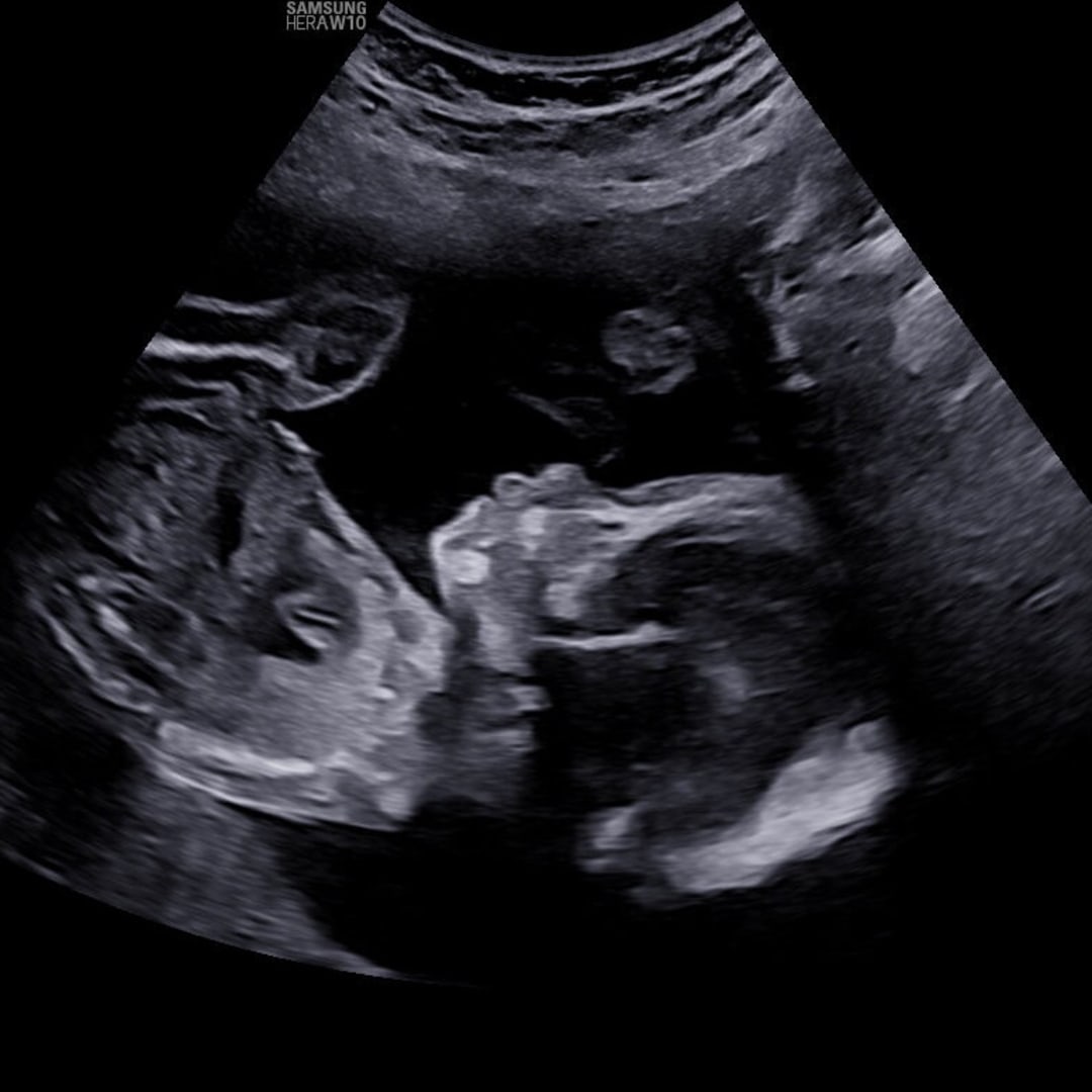 Photo shared by Aryka for their Babylist baby registry.