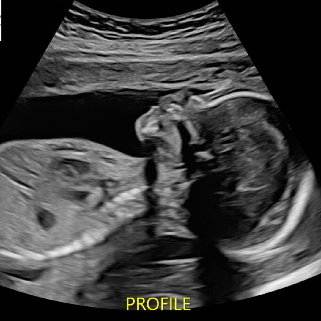 Photo shared by Ashley for their Babylist baby registry.