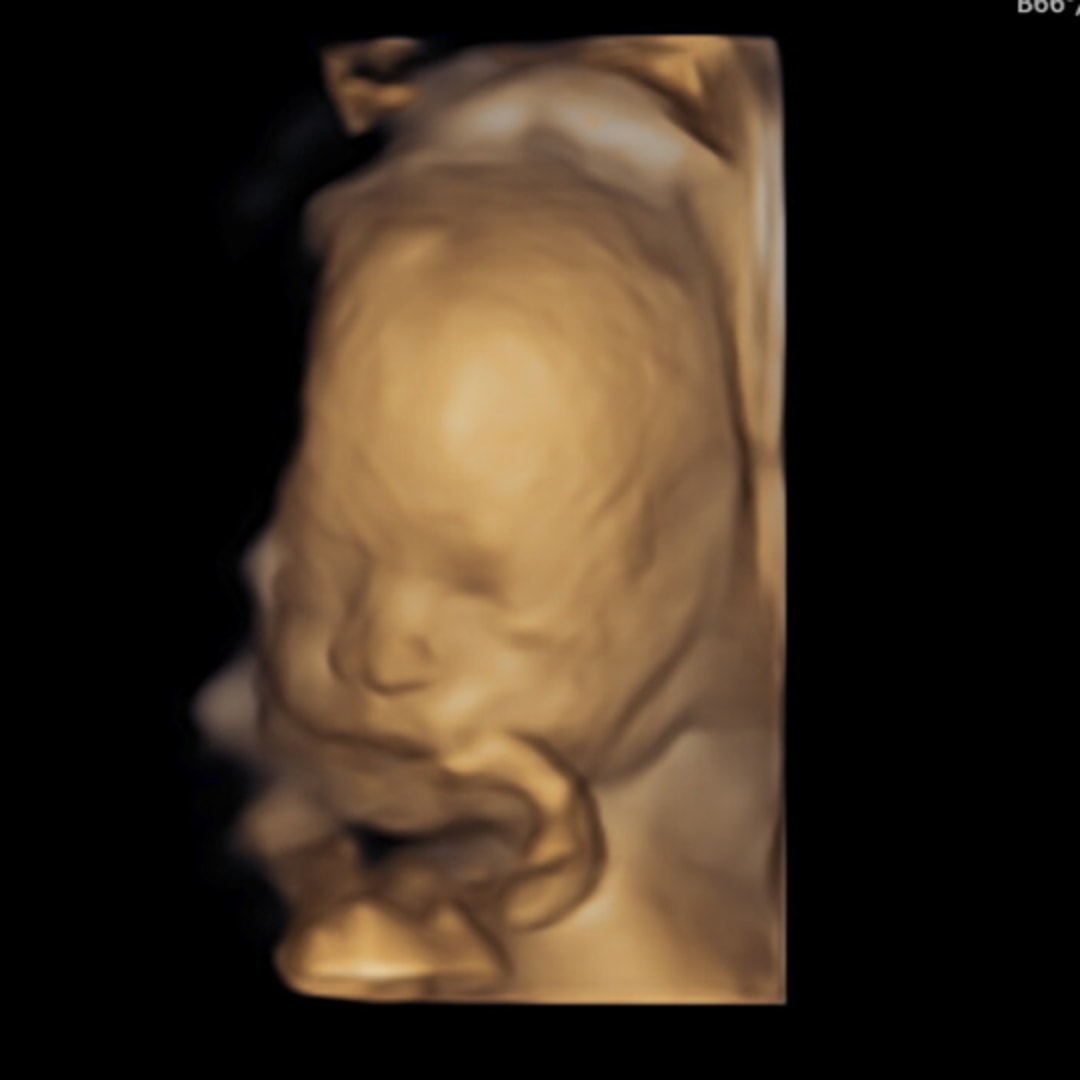 Photo shared by Autumn for their Babylist baby registry.