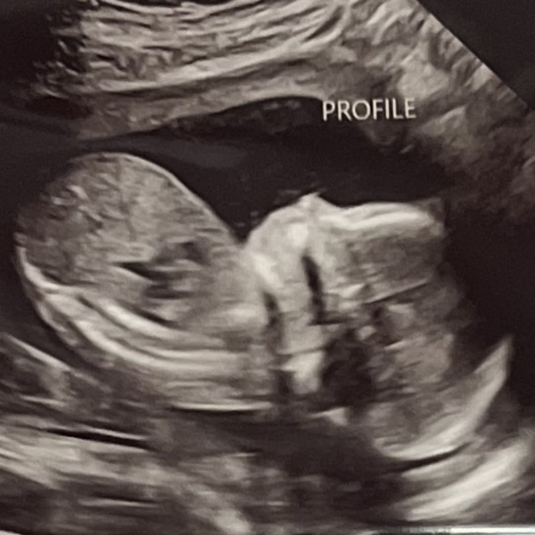 Photo shared by Jaylee for their Babylist baby registry.