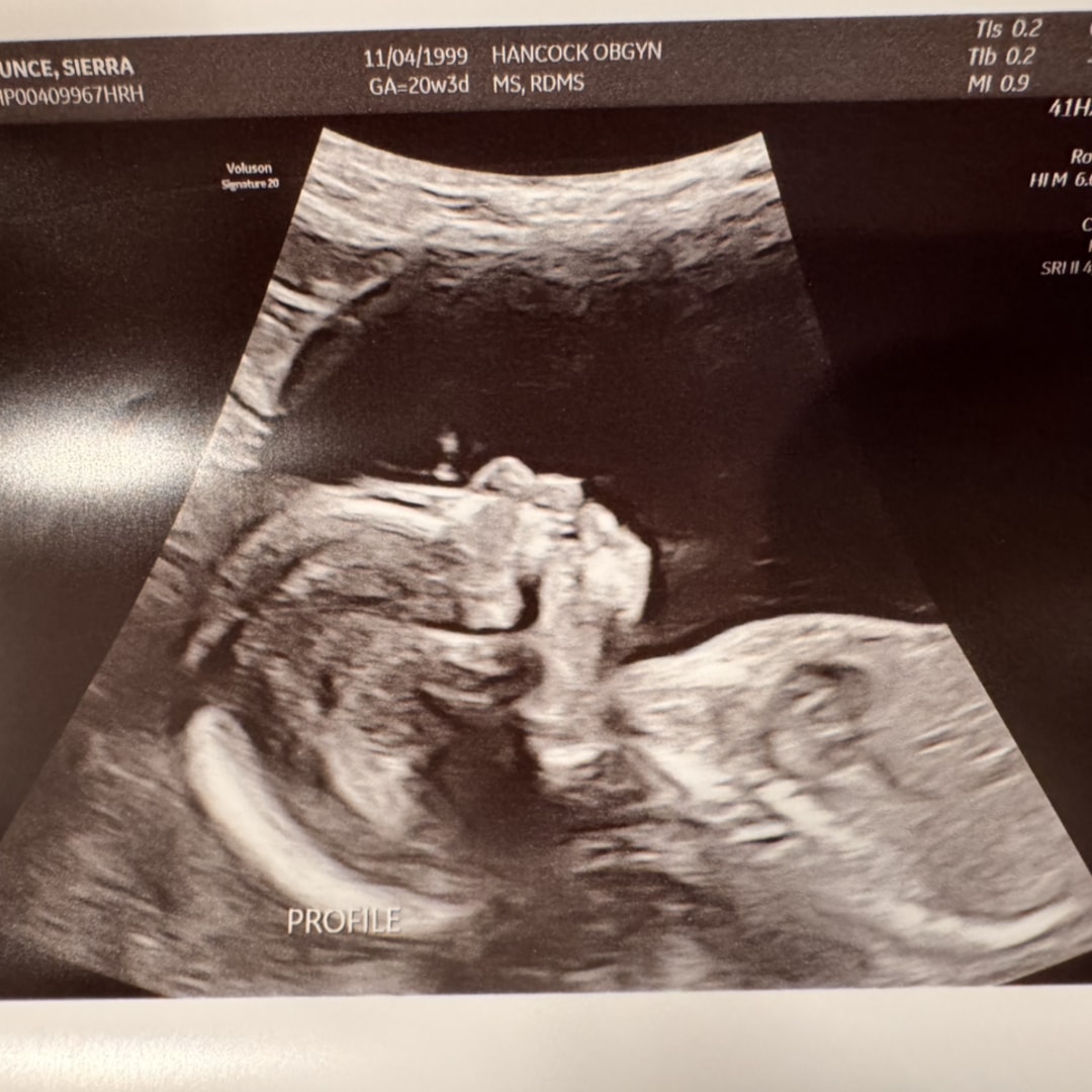 Photo shared by Sierra for their Babylist baby registry.