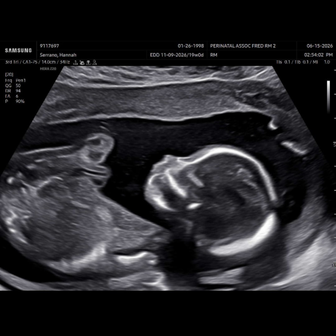 Photo shared by Hannah for their Babylist baby registry.