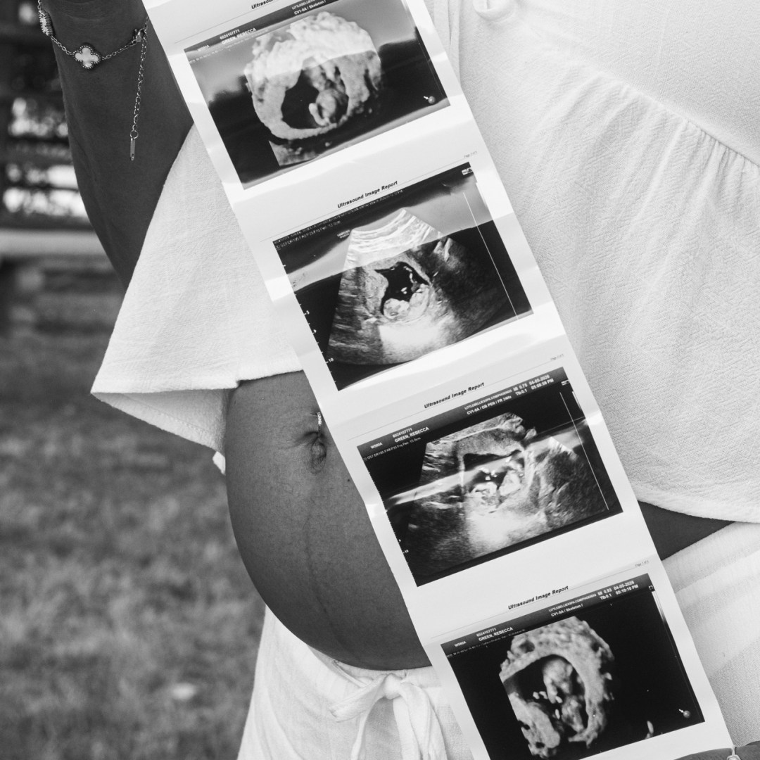 Photo shared by Bekah for their Babylist baby registry.