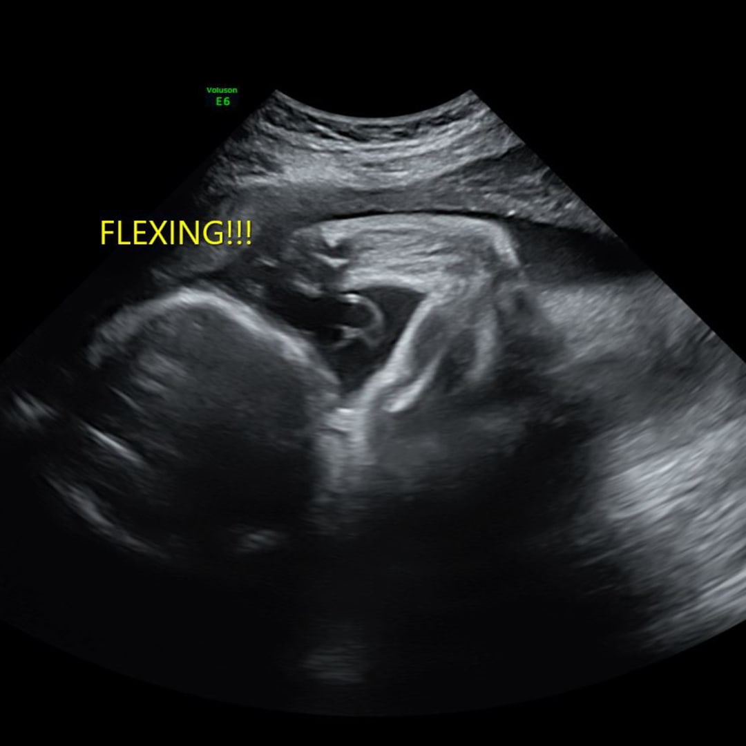 Photo shared by Jessica for their Babylist baby registry.