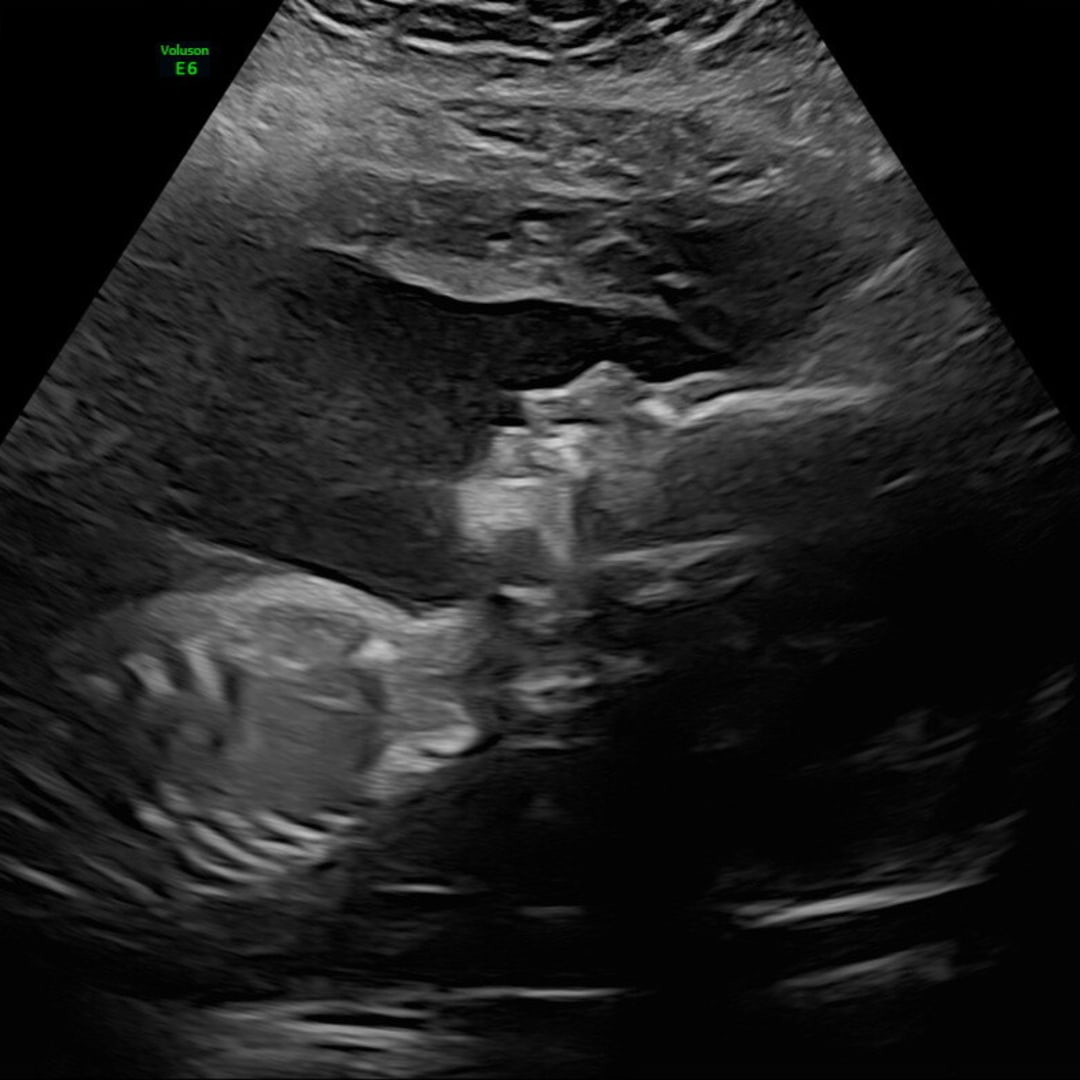 Photo shared by Alissa for their Babylist baby registry.