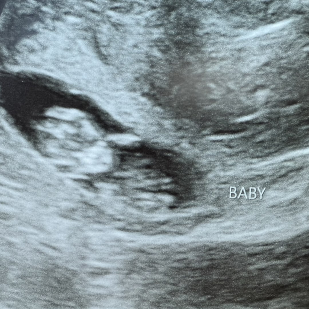Photo shared by Sarah for their Babylist baby registry.