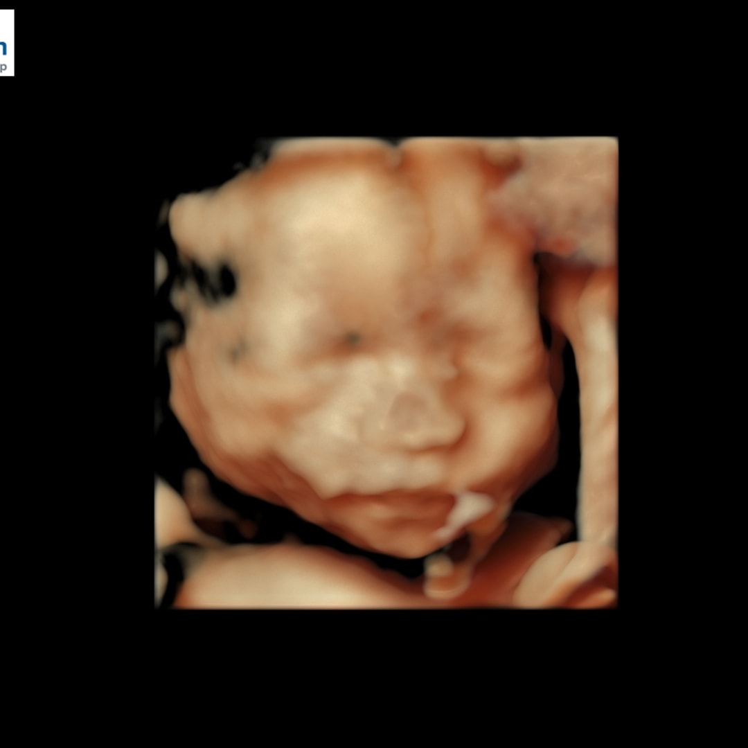 Photo shared by Dawn Ivy for their Babylist baby registry.