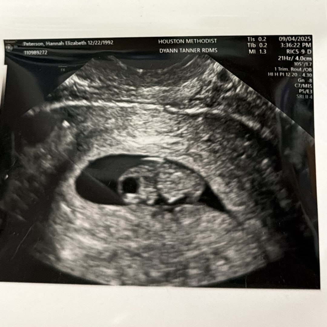 Photo shared by Hannah for their Babylist baby registry.