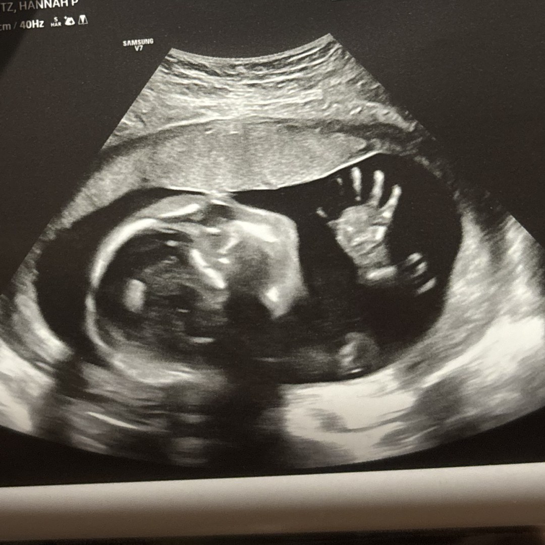Photo shared by Hannah for their Babylist baby registry.