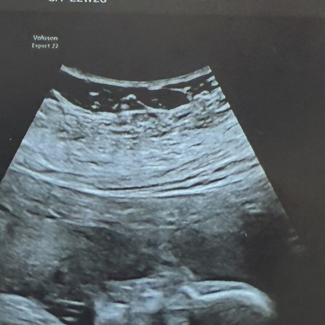 Photo shared by Alicia for their Babylist baby registry.