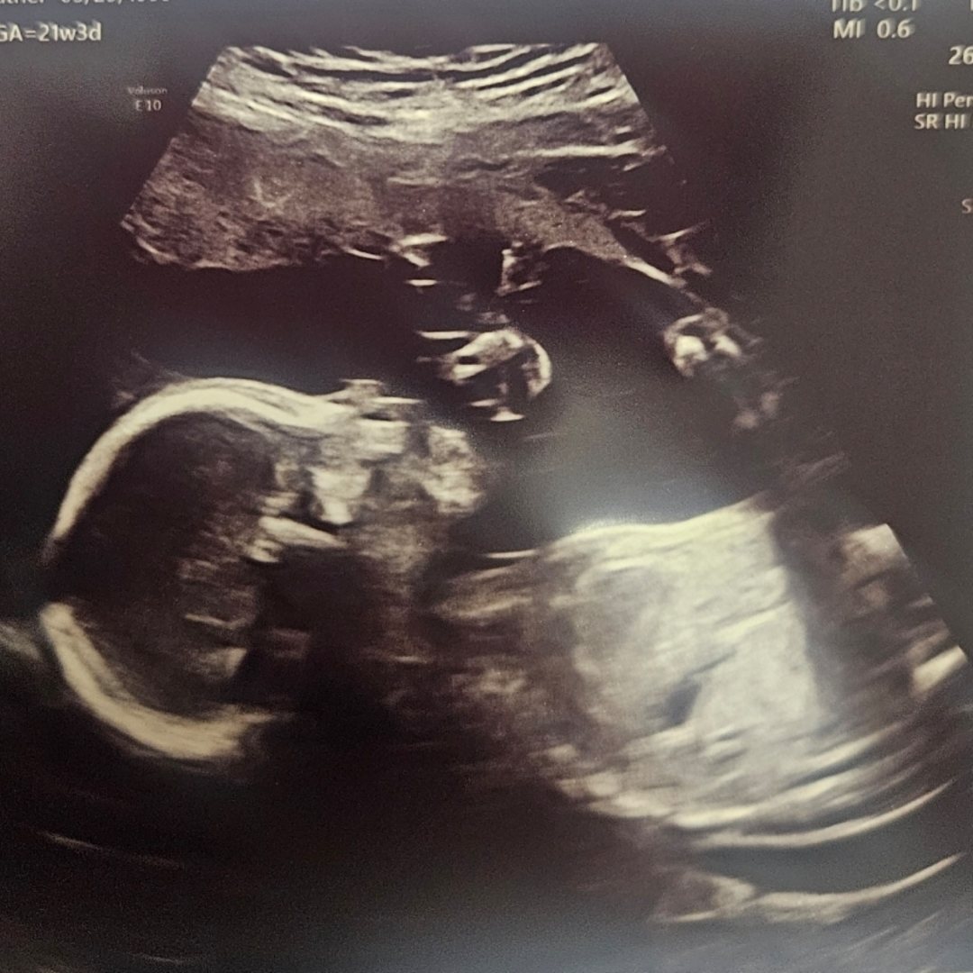 Photo shared by Heather for their Babylist baby registry.