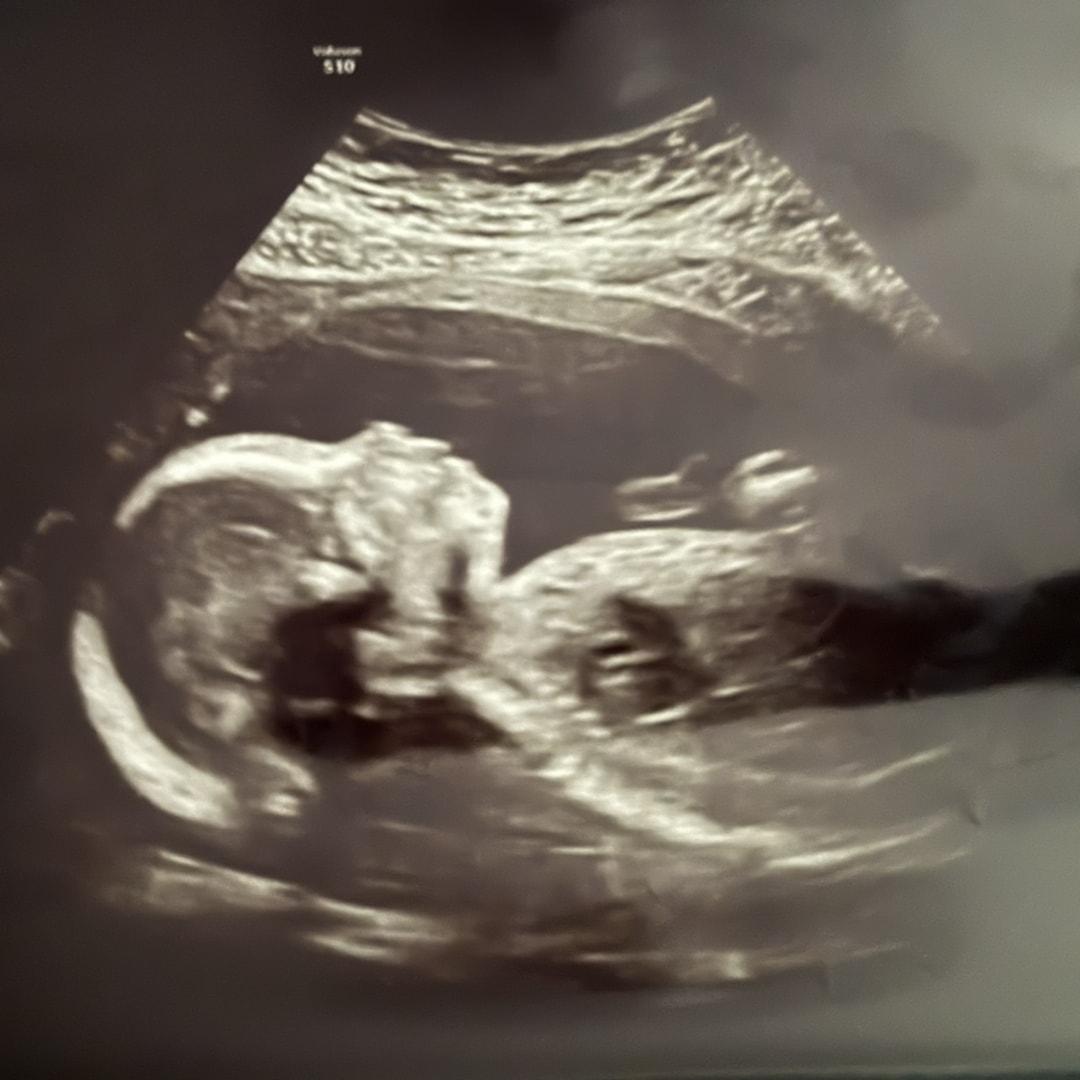 Photo shared by Maya for their Babylist baby registry.